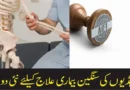 ہڈیوں کی سنگین بیماری علاج کیلئے نئی دوا